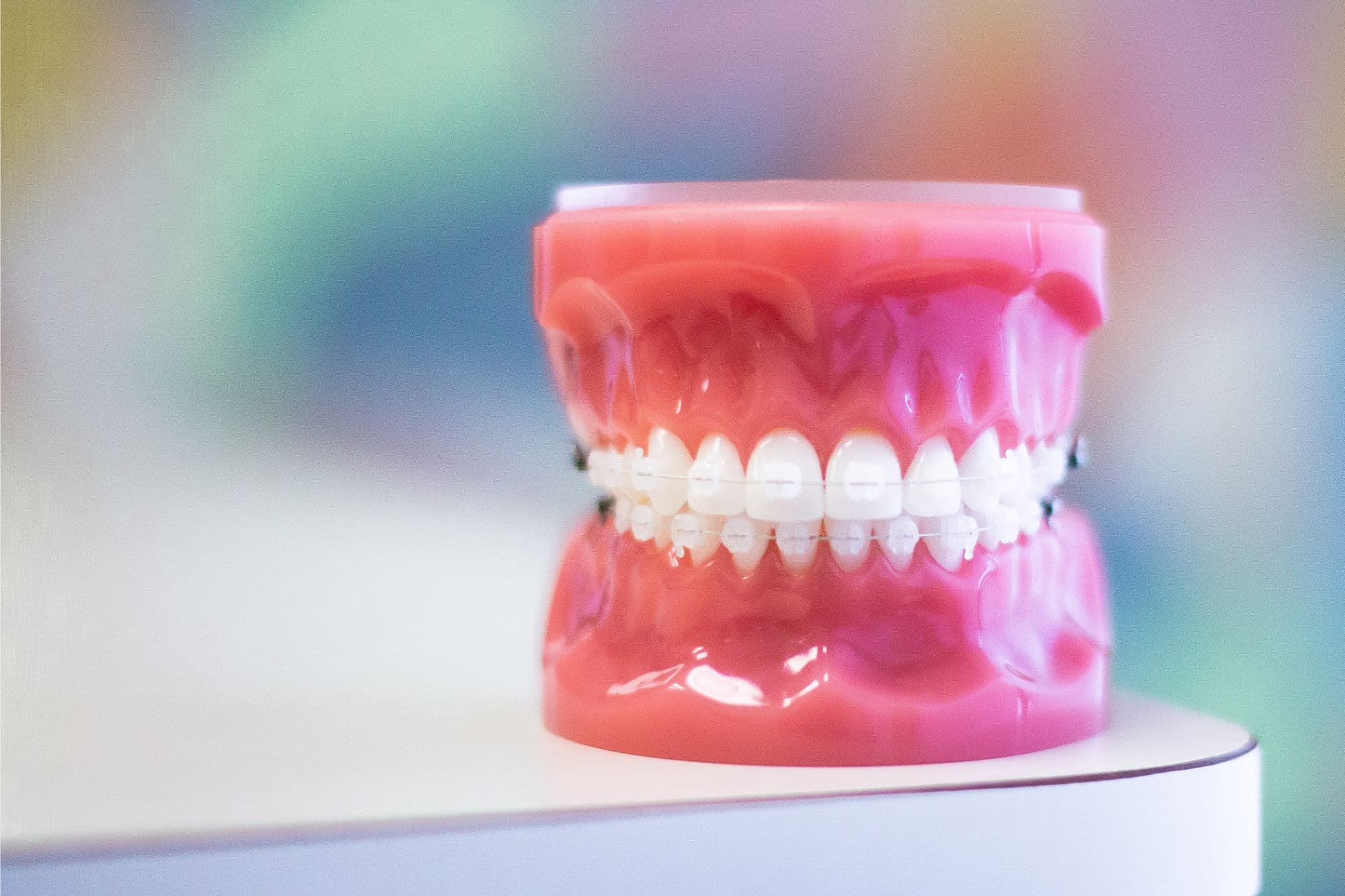 Model of teeth with clear ceramic braces, demonstrating orthodontic treatment options at Foley Orthodontics in Cary, NC, highlighting benefits of clear aligners and braces for effective dental correction.