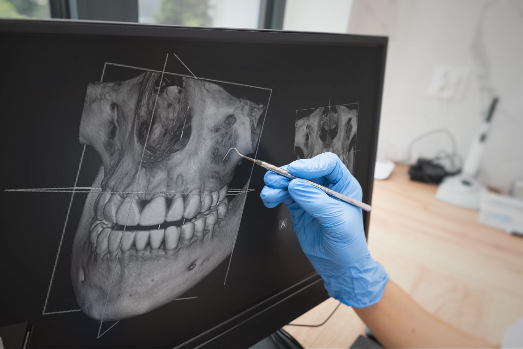 How Orthodontics and Jaw Surgery Work Together