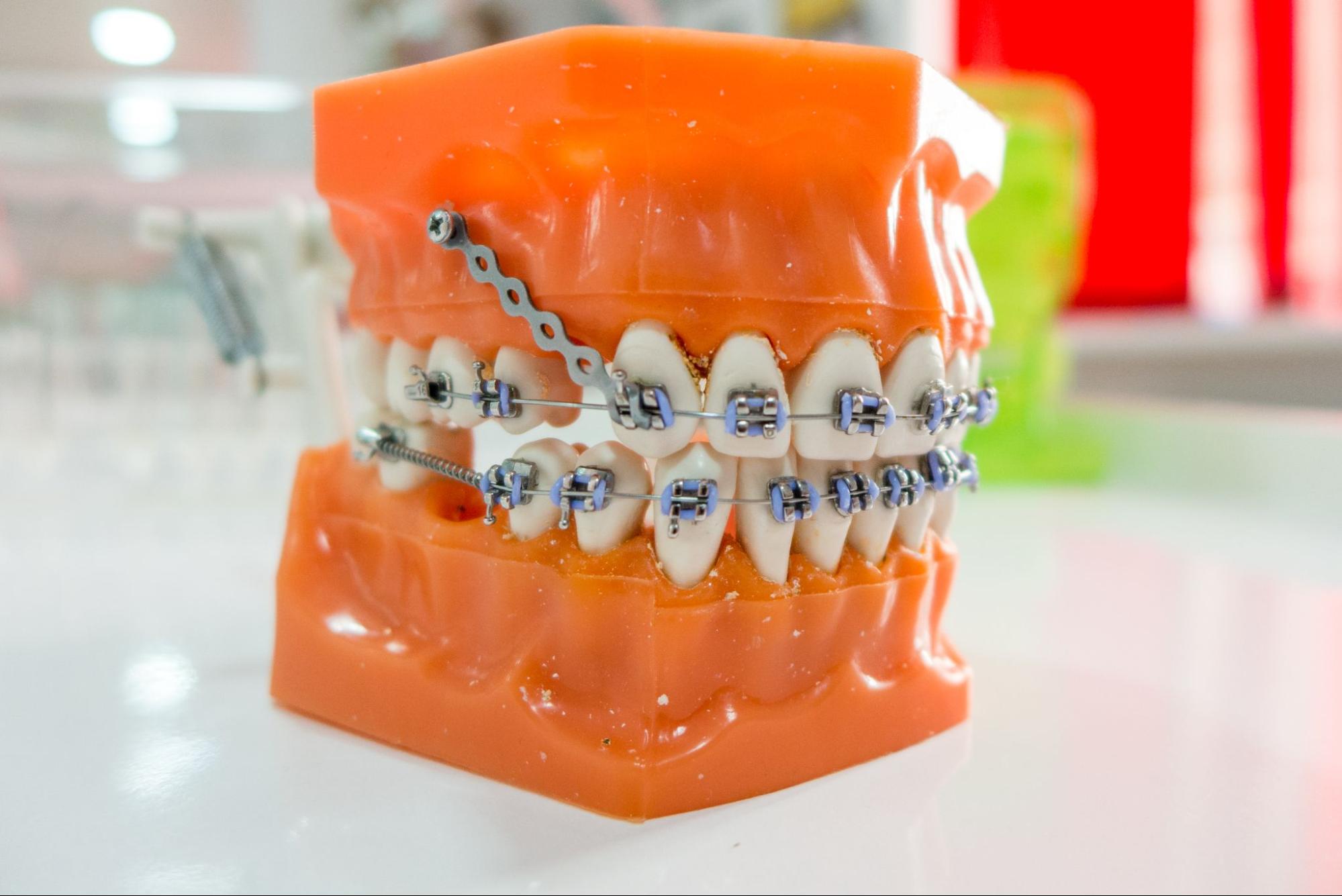 TADs Explained: What They Are and How They Work